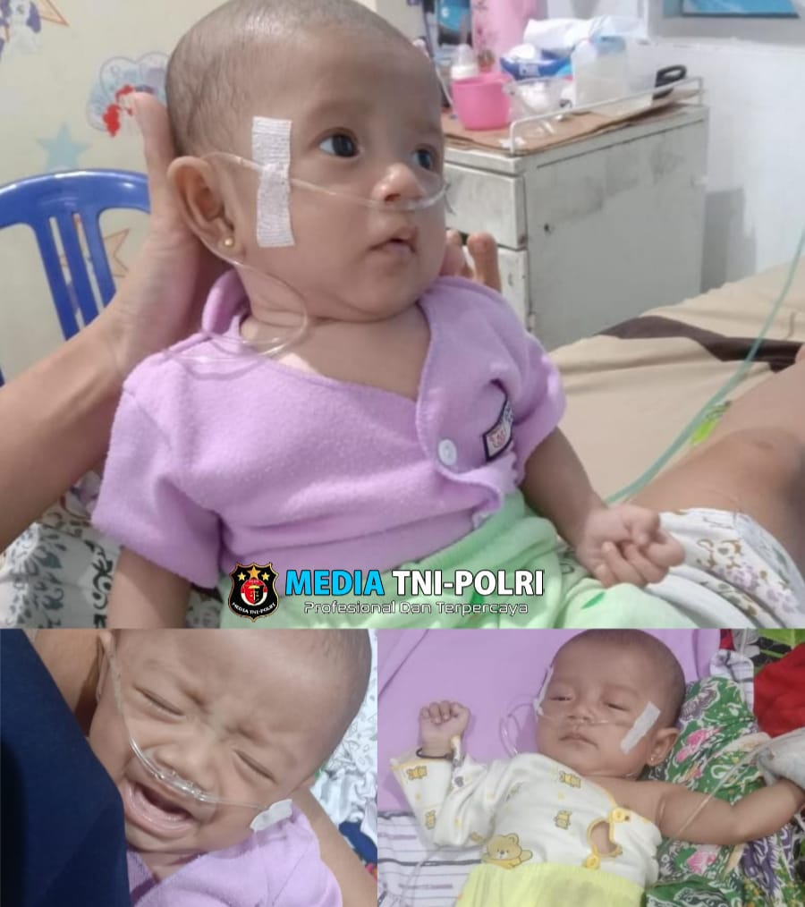 Bayi Mungil asal Tanggamus, Haura Al-Maira Berjuang Melawan Jantung Bocor, Butuh Uluran Tangan Dermawan