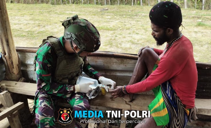 Respon Cepat, Satgas Yonif 323/Buaya Putih Kostrad Obati Luka Masyarakat Kampung Mayuberi