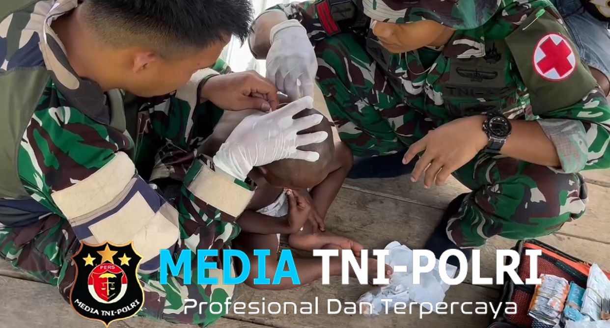 Pos Selal Satgas Yonif 751/VJS Tangani Cacar/Bisul pada Anak Pengobatan Gratis & Edukasi Kebersihan Lingkungan