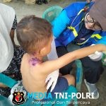 Kodam Iskandar Muda Gelar Trauma Healing dan Pengobatan Gratis di Lokasi Pengungsian Desa Bungkah