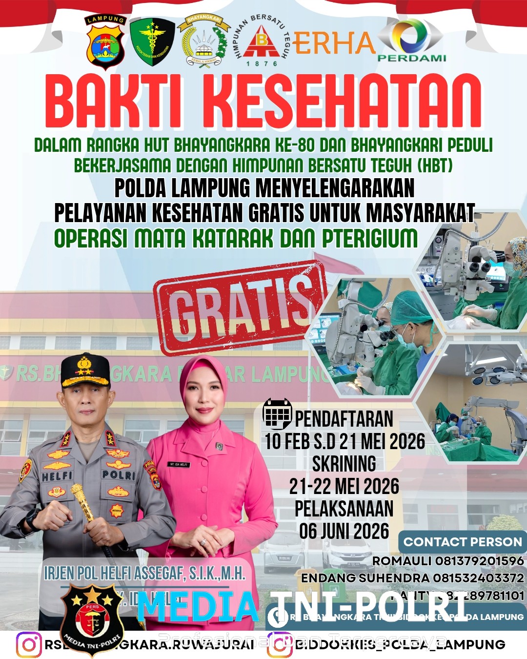 Polda Lampung Gelar Bakti Kesehatan Operasi Katarak dan Pterigium Gratis, Ini Jadwalnya